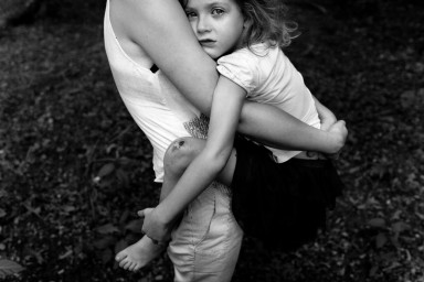 Разбитая губа