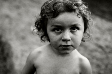 Разбитый нос, рентген и гости